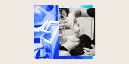 Skin Tightening Procedures Might Take Over Facelift Trend