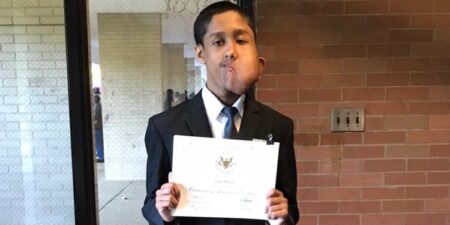 IBM Intern Living With Neurofibromatosis Shares His Top Career Lessons