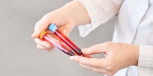 A 0 blood test promises to detect 50 different kinds of cancer. The results come with major caveats.