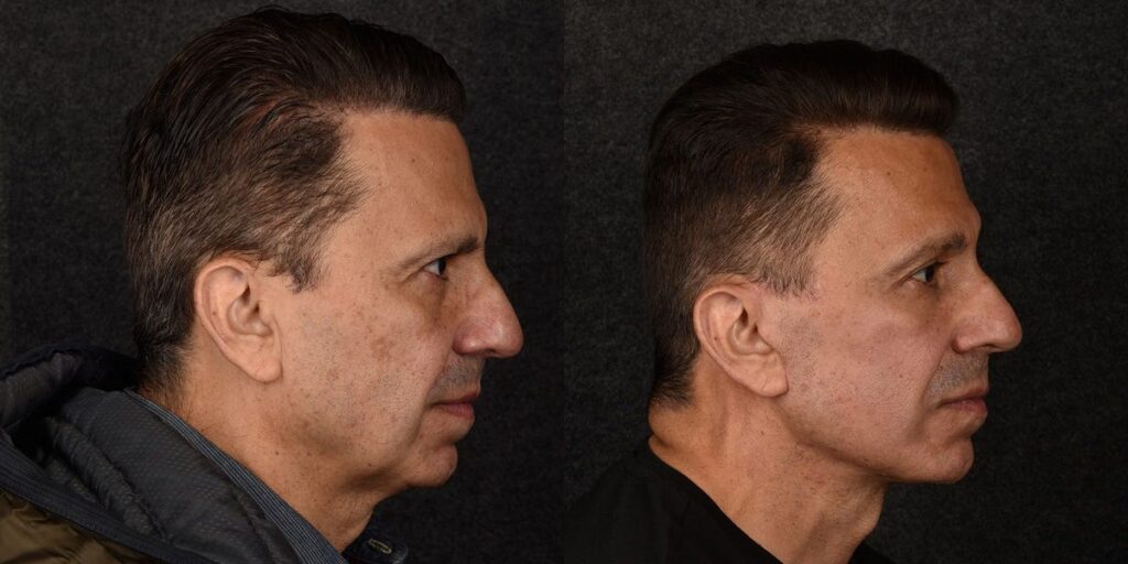 C-suite execs are paying surgeons big money to look fresh-faced, approachable, and less irritable