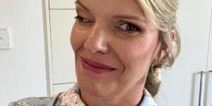 A facial injury changed my appearance — and my life. I’m strong and confident now, and I want others to feel the same.