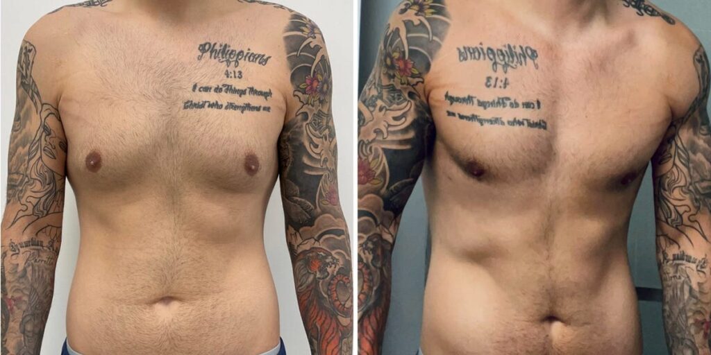 Men get cosmetic surgery, too. I spent ,000 on plastic surgery, and I don’t regret it.