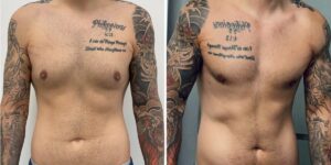 Men get cosmetic surgery, too. I spent ,000 on plastic surgery, and I don’t regret it.